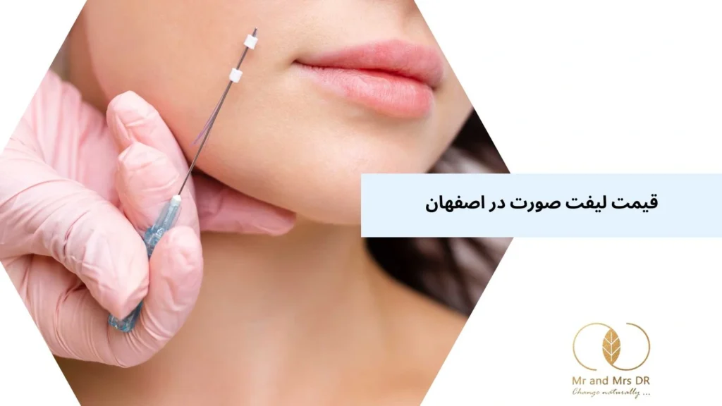 قیمت لیفت صورت در اصفهان