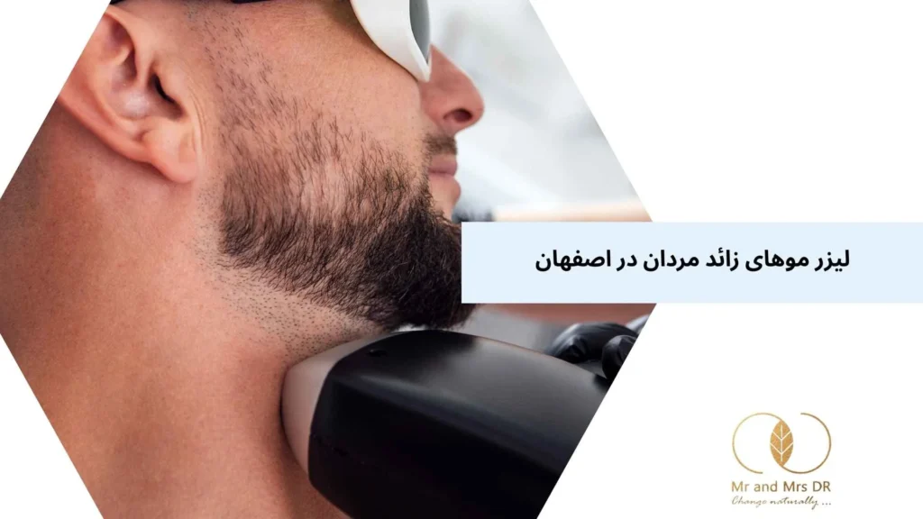 لیزر موهای زائد مردان در اصفهان