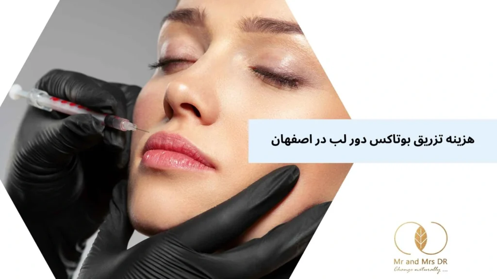 هزینه تزریق بوتاکس دور لب در اصفهان