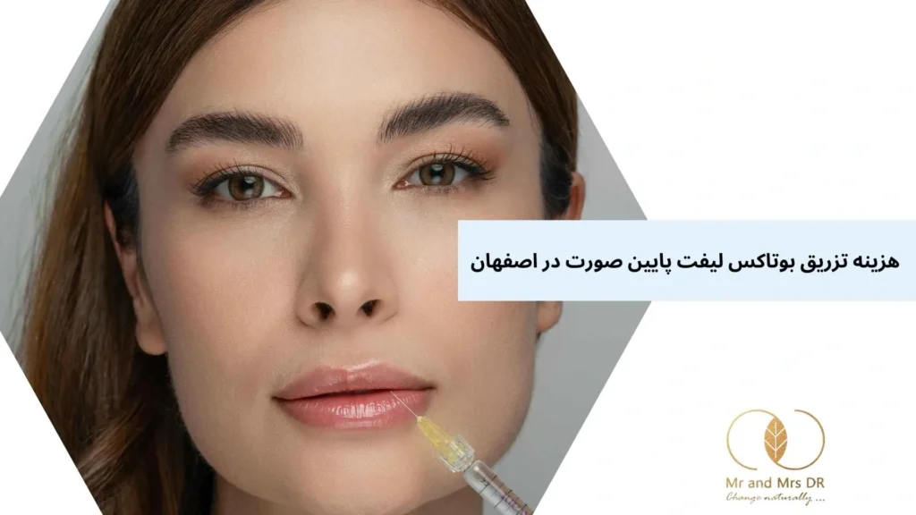 هزینه تزریق بوتاکس لیفت پایین صورت در اصفهان