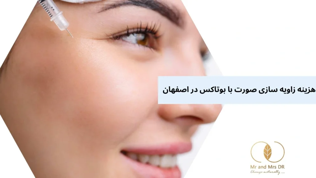 هزینه زاویه سازی صورت با بوتاکس در اصفهان