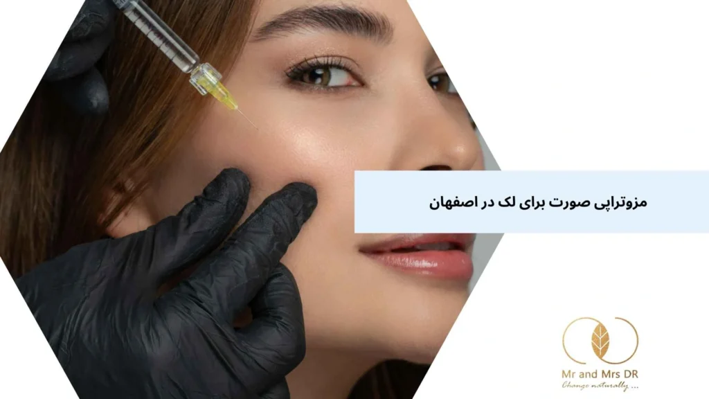 مزوتراپی صورت برای لک در اصفهان
