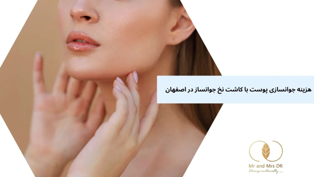 هزینه جوانسازی پوست با کاشت نخ جوانساز در اصفهان