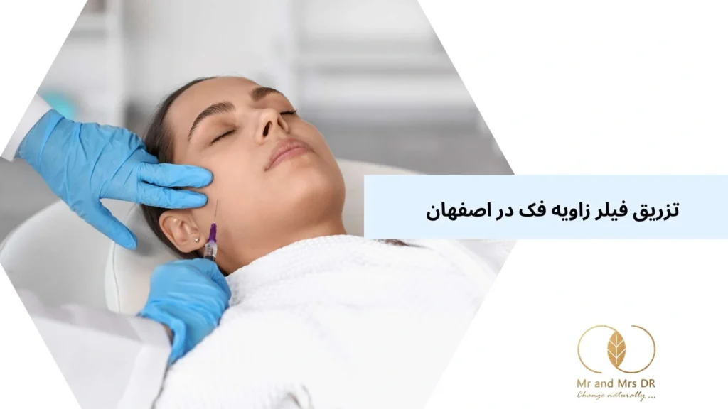 تزریق فیلر زاویه فک در اصفهان