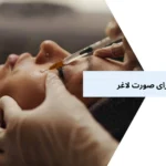 تزریق ژل برای صورت لاغر