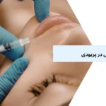 تزریق ژل در پریودی