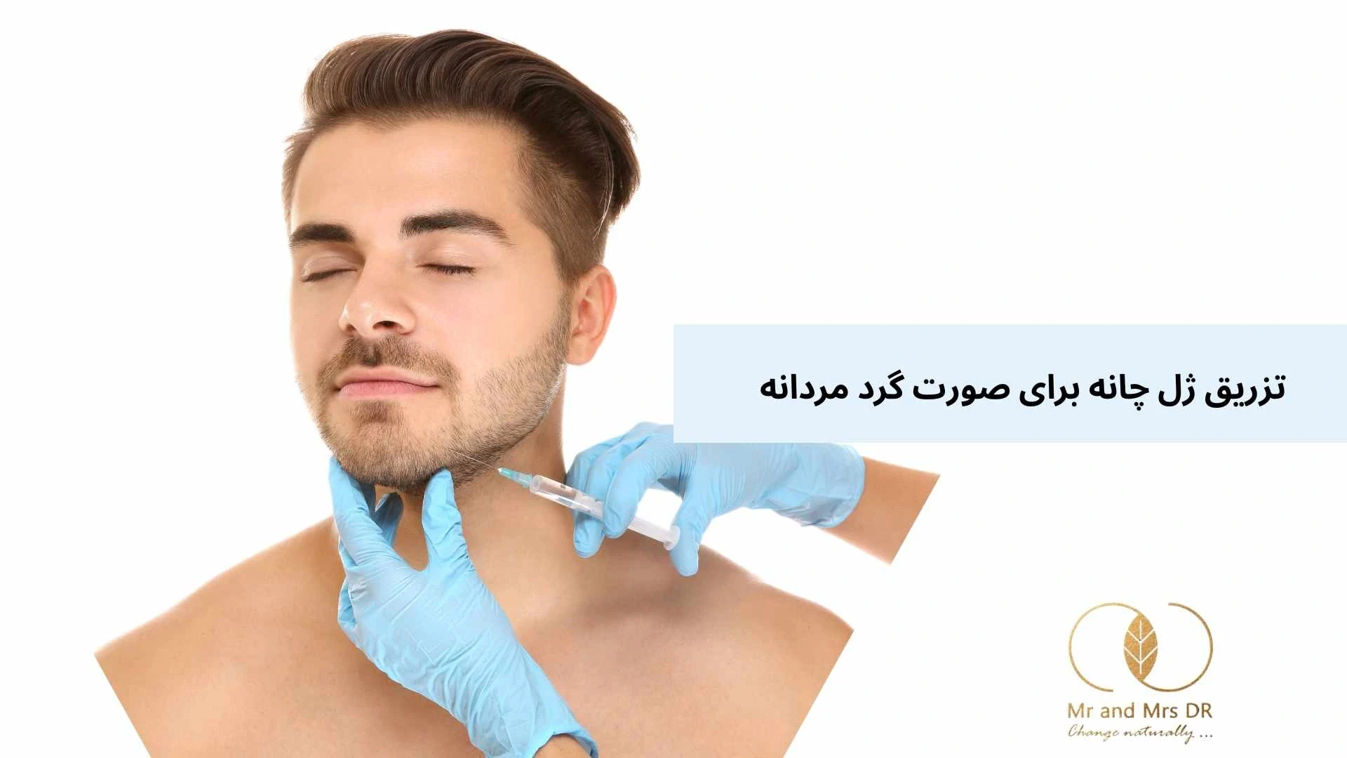 تزریق ژل چانه برای صورت گرد مردانه