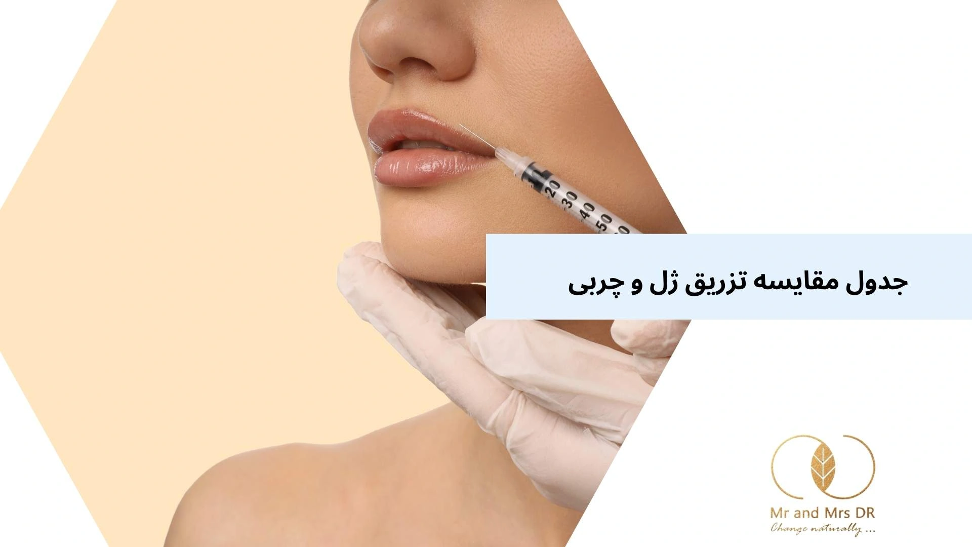 جدول مقایسه تزریق ژل و چربی