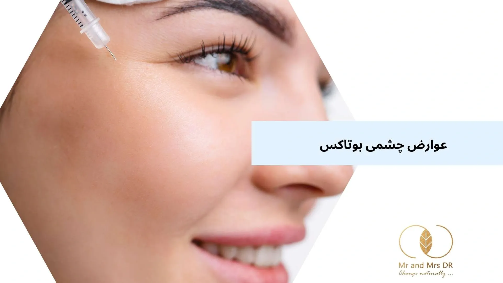 عوارض چشمی بوتاکس 