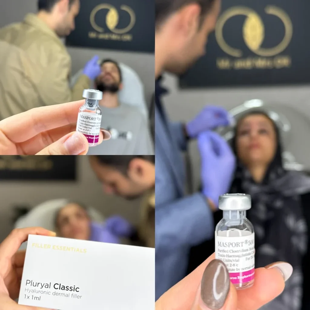 عکس بوتاکس چشم گربه ای در اصفهان