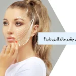 لیفت با نخ آپتوس چقدر ماندگاری دارد؟