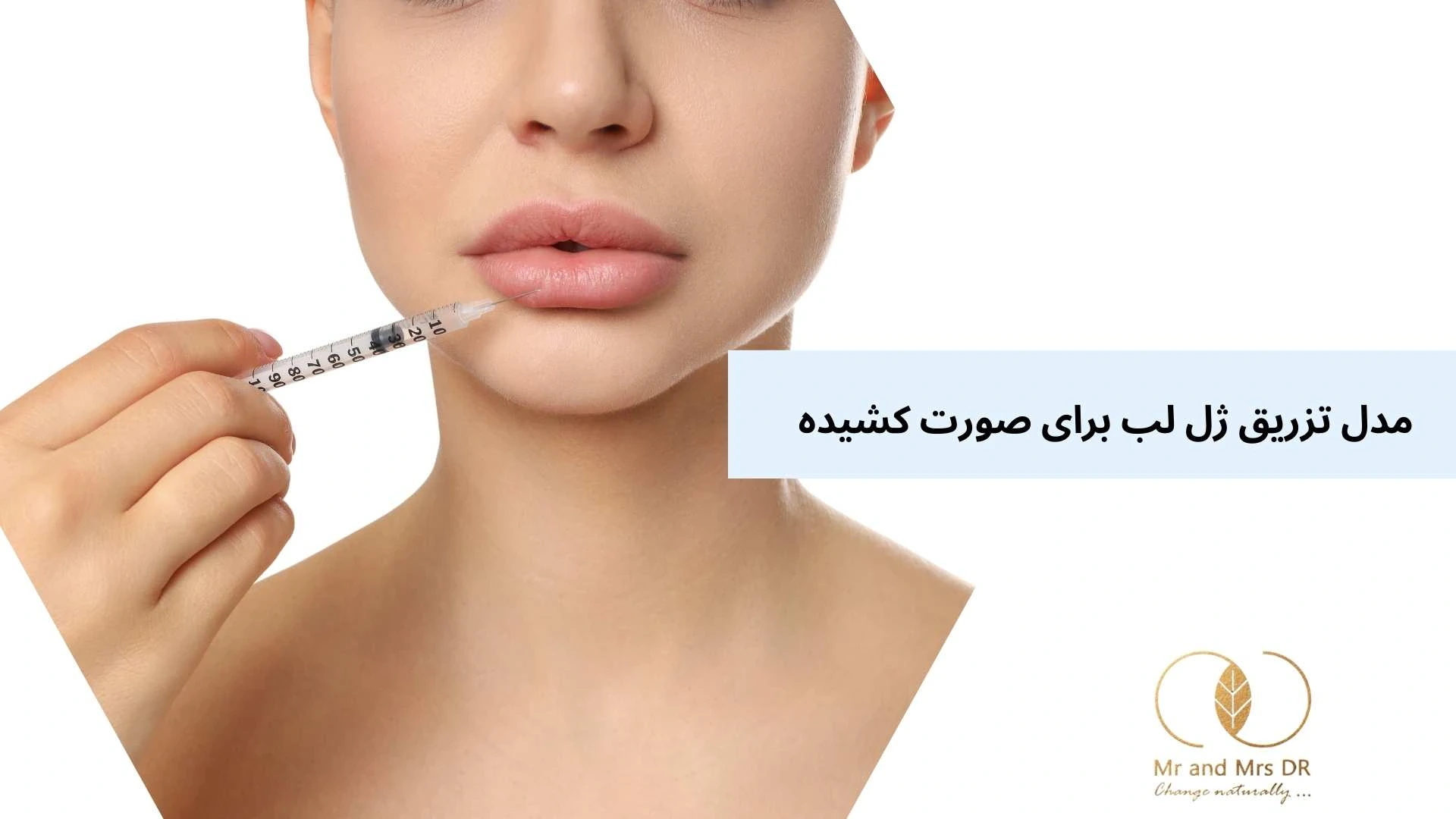 مدل تزریق ژل لب برای صورت کشیده