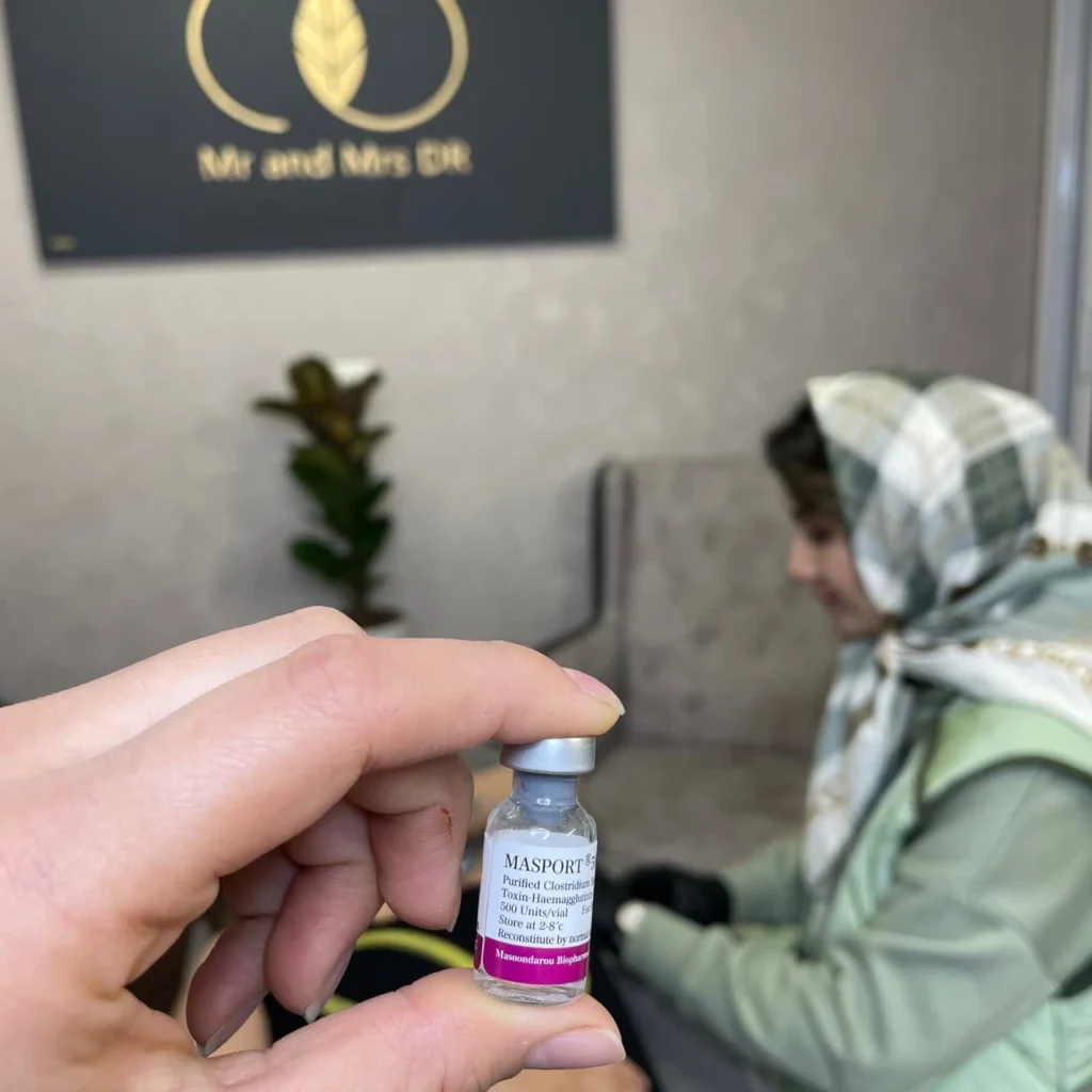 نمونه کار تزریق بوتاکس میگرن در اصفهان