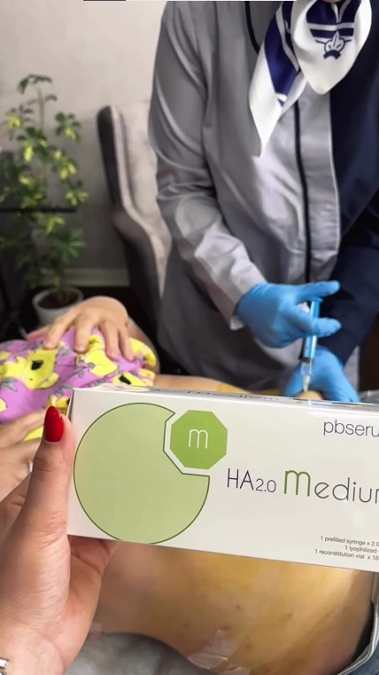 نمونه کار لاغری با نخ امبدینگ در اصفهان