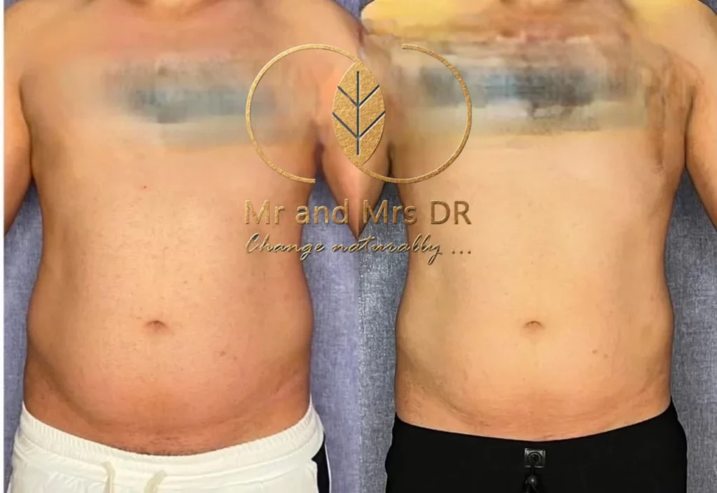 نمونه کار لاغری در اصفهان