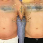 نمونه کار لاغری در اصفهان