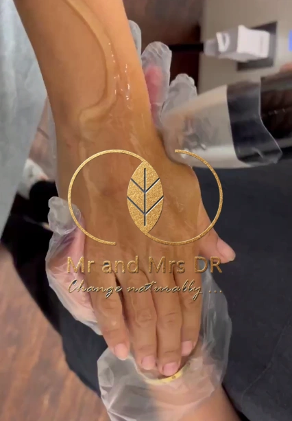 نمونه کار لیزر در اصفهان