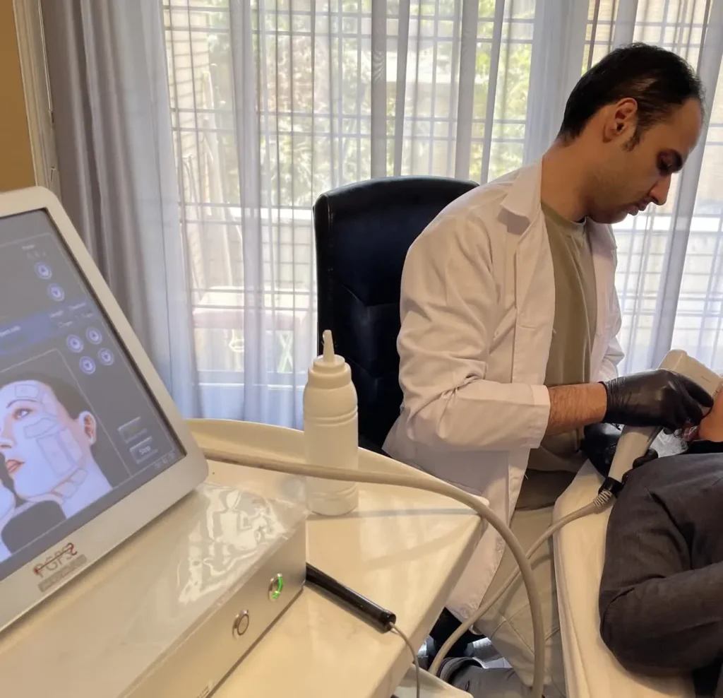 نمونه کار لیفت صورت با هایفوتراپی در اصفهان