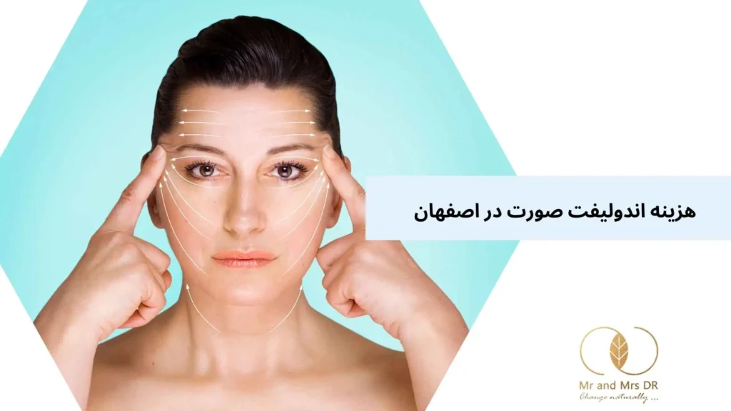 هزینه اندولیفت صورت در اصفهان
