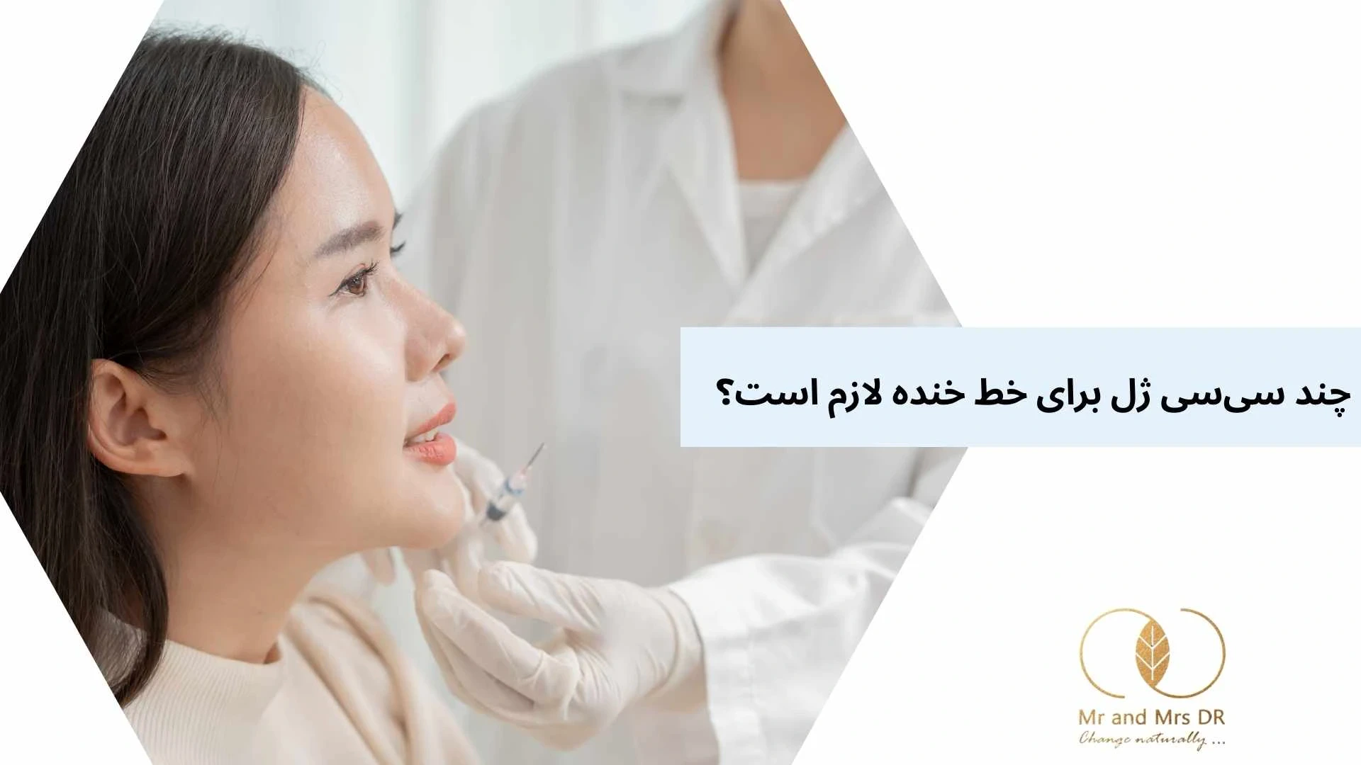 چند سی‌سی ژل برای خط خنده لازم است؟